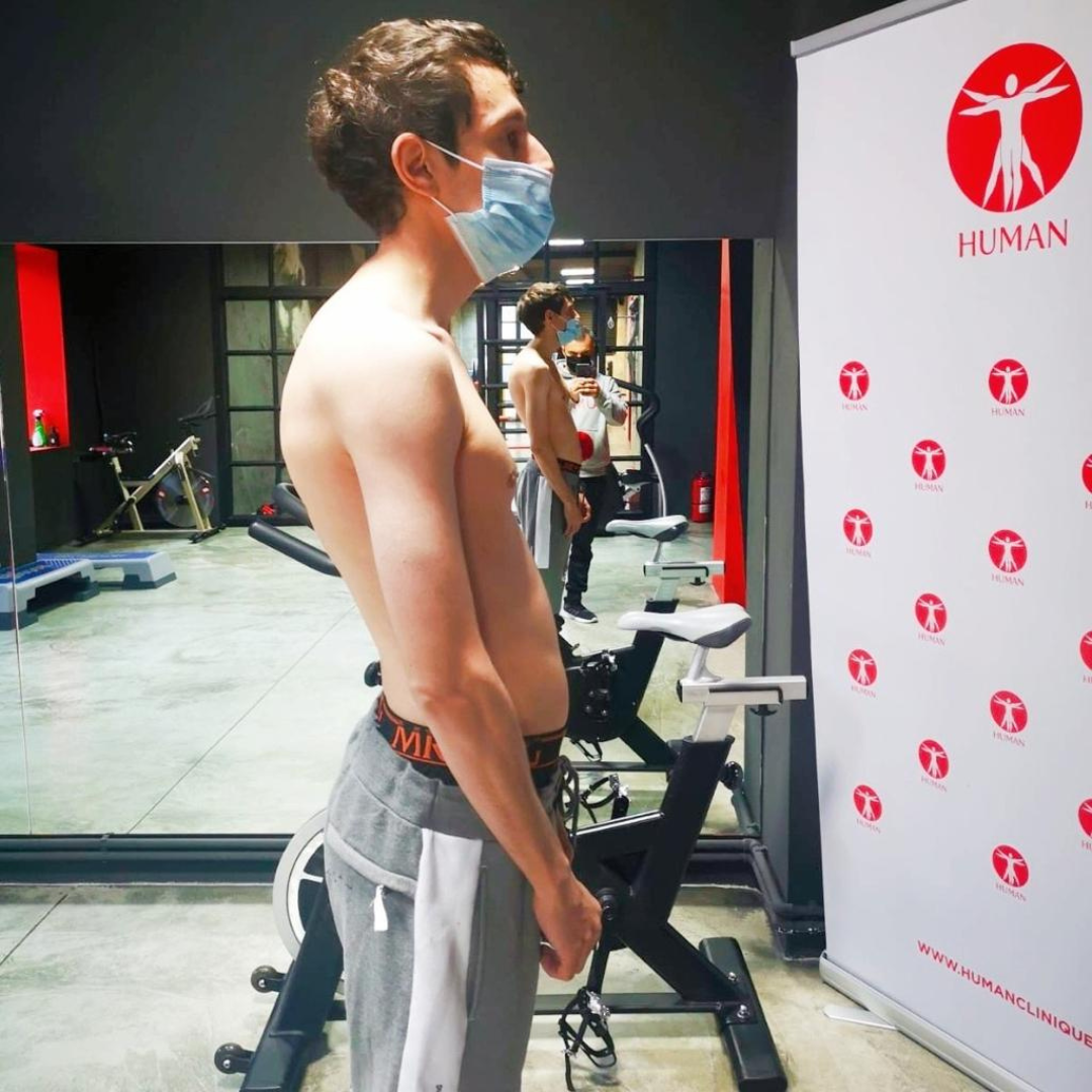 Postural correction exercises