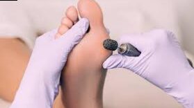 Alexis d'Halluin: osteopath in corn-corn-corn | Monitoring and prevention