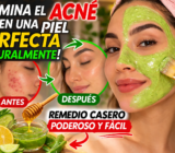 ¡Piel de porcelana de forma natural! El remedio casero que está ayudando a eliminar el acné y mejorar la apariencia de la piel
