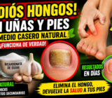 ELIMINA LOS HONGOS EN UÑAS Y PIES DESDE CASA! El remedio natural que NADIE te está contando”